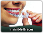 More Info on Invisible Braces More Info on Invisible Braces In August, ME